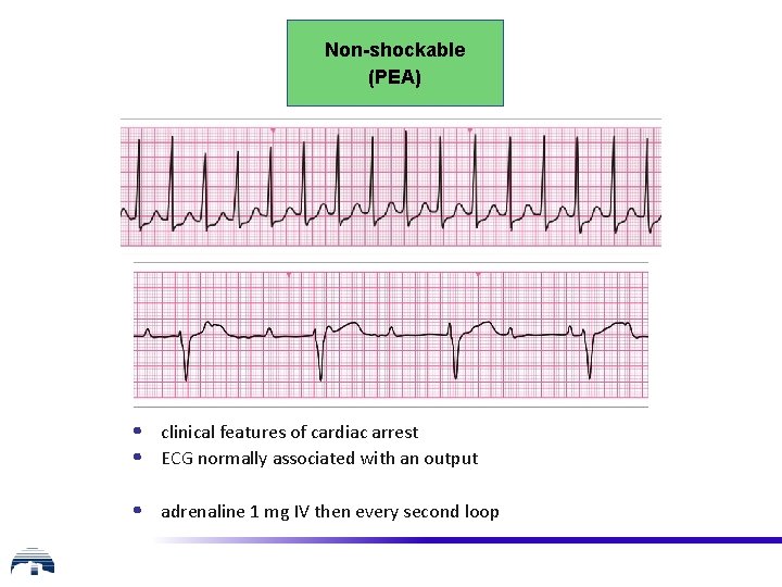 Non-shockable (PEA) • clinical features of cardiac arrest • ECG normally associated with an