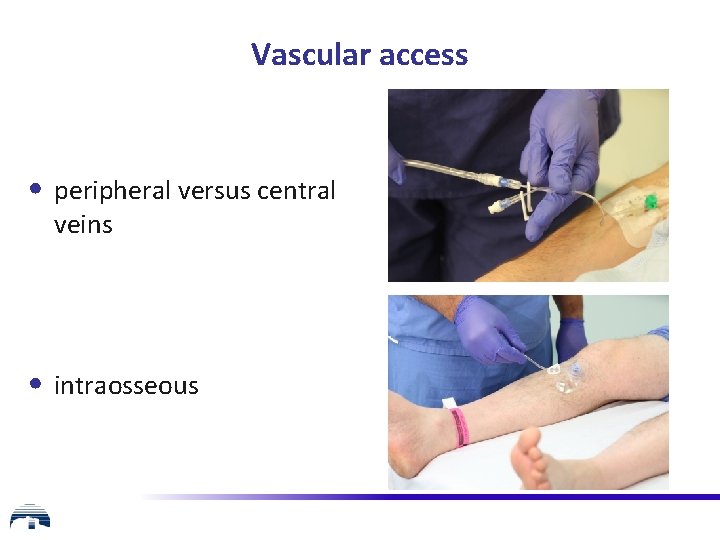 Vascular access • peripheral versus central veins • intraosseous 