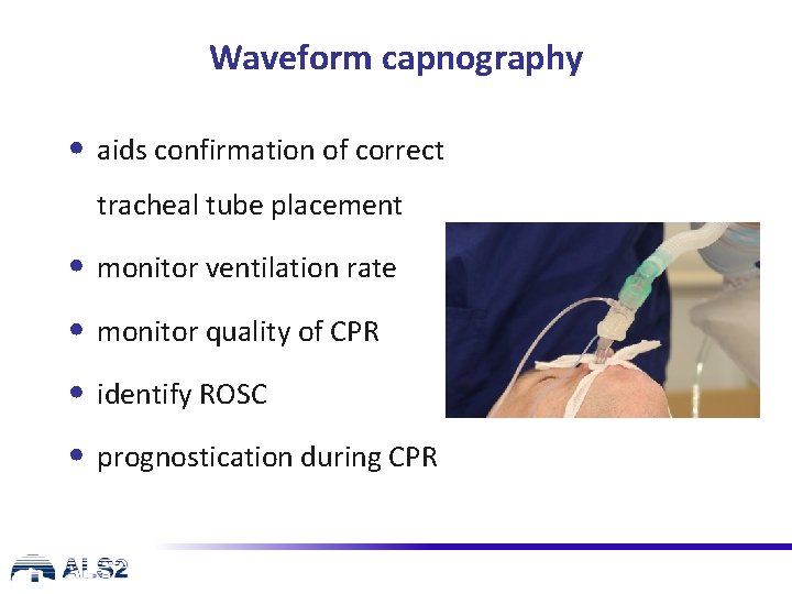 Waveform capnography • aids confirmation of correct tracheal tube placement • monitor ventilation rate
