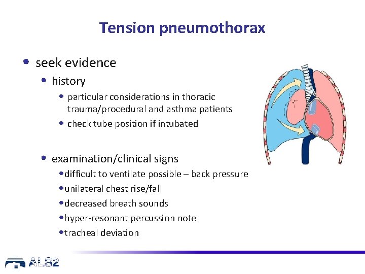 Tension pneumothorax • seek evidence • history • particular considerations in thoracic trauma/procedural and