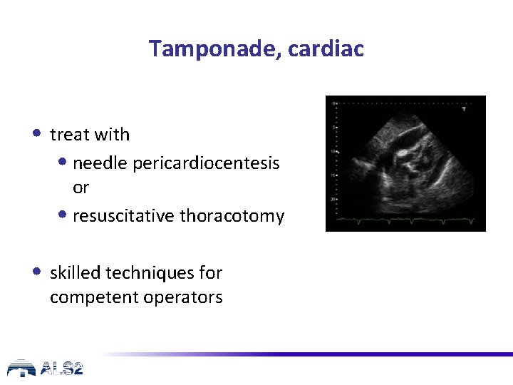 Tamponade, cardiac • treat with • needle pericardiocentesis or • resuscitative thoracotomy • skilled