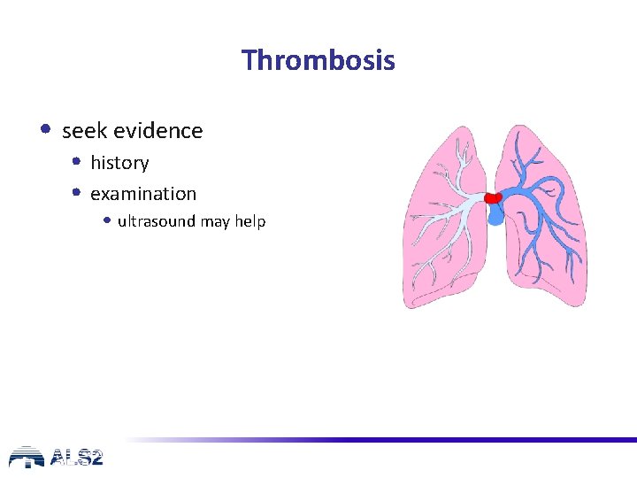 Thrombosis • seek evidence • history • examination • ultrasound may help 