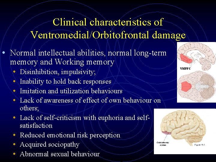 Clinical characteristics of Ventromedial/Orbitofrontal damage • Normal intellectual abilities, normal long-term memory and Working