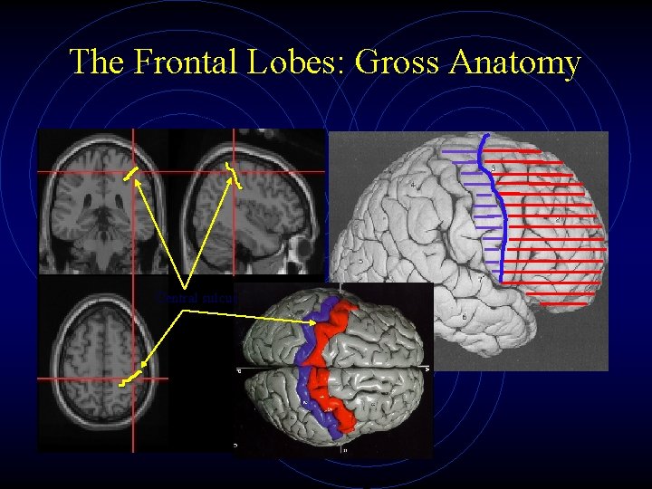 The Frontal Lobes: Gross Anatomy Central sulcus 