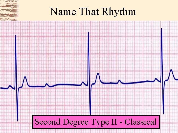 Name That Rhythm Second Degree Type II - Classical 