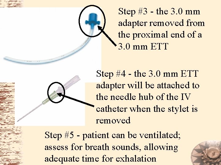 Step #3 - the 3. 0 mm adapter removed from the proximal end of