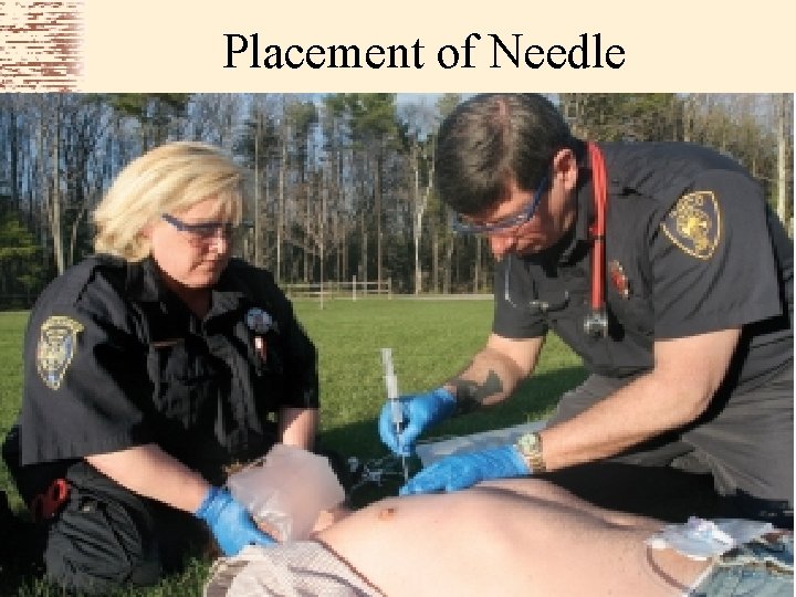 Placement of Needle 