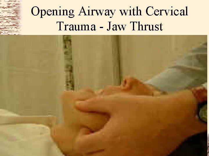 Opening Airway with Cervical Trauma - Jaw Thrust 