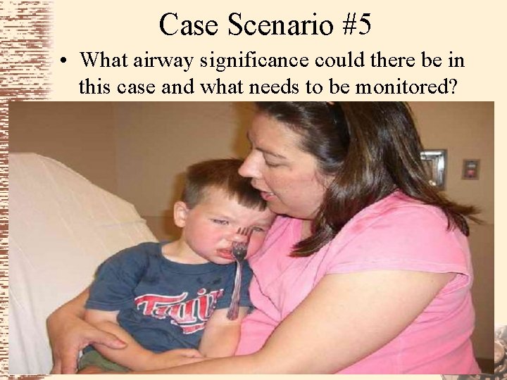 Case Scenario #5 • What airway significance could there be in this case and