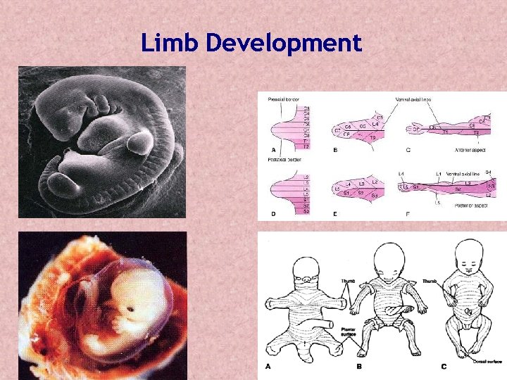 Limb Development Limb Development