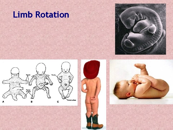 Limb Rotation Limb Rotation