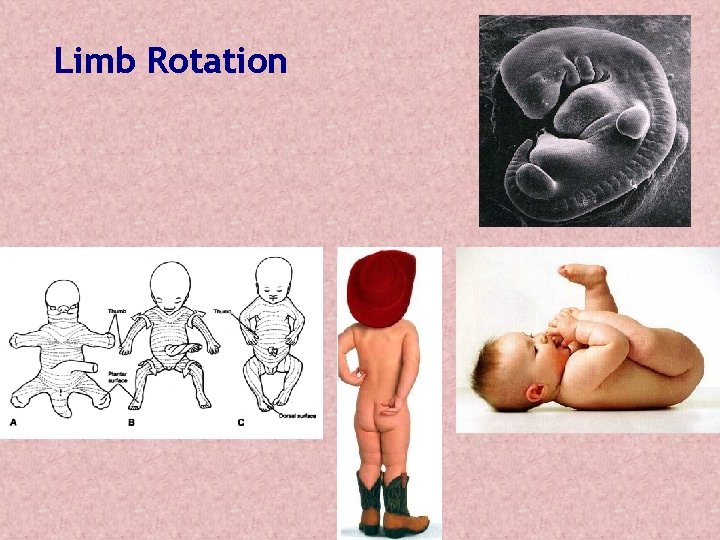 Limb Rotation 