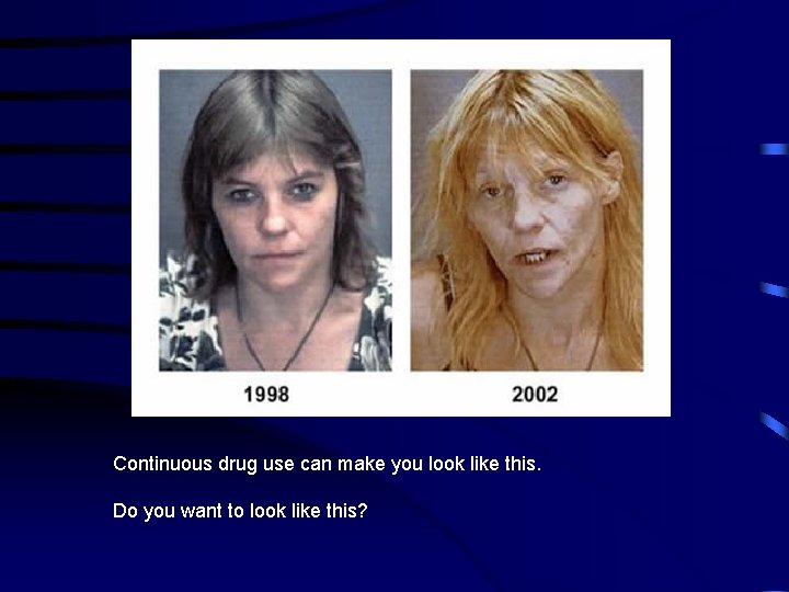 Continuous drug use can make you look like this. Do you want to look