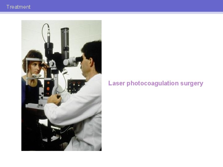 Treatment Laser photocoagulation surgery 