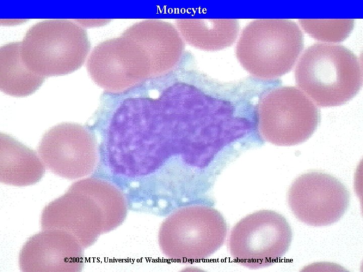 Monocyte © 2002 MTS, University of Washington Department of Laboratory Medicine 