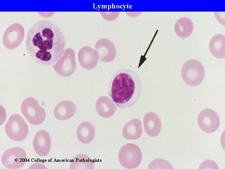 Lymphocyte © 2004 College of American Pathologists 