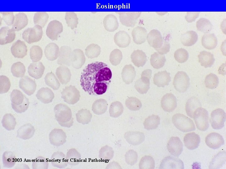 Eosinophil © 2003 American Society for Clinical Pathology 