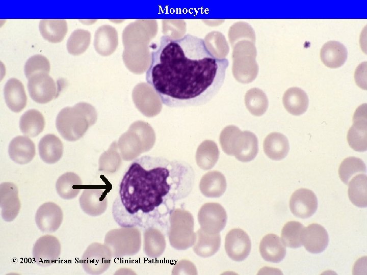 Monocyte © 2003 American Society for Clinical Pathology 