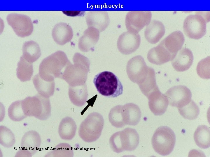 Lymphocyte © 2004 College of American Pathologists 