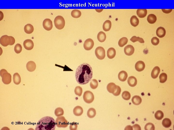 Segmented Neutrophil © 2004 College of American Pathologists 