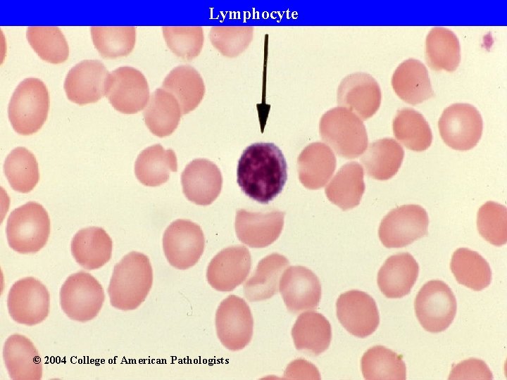 Lymphocyte © 2004 College of American Pathologists 