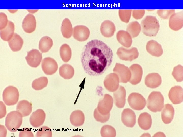 Segmented Neutrophil © 2004 College of American Pathologists 