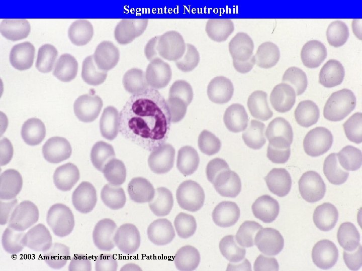 Segmented Neutrophil © 2003 American Society for Clinical Pathology 