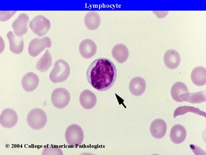 Lymphocyte © 2004 College of American Pathologists 