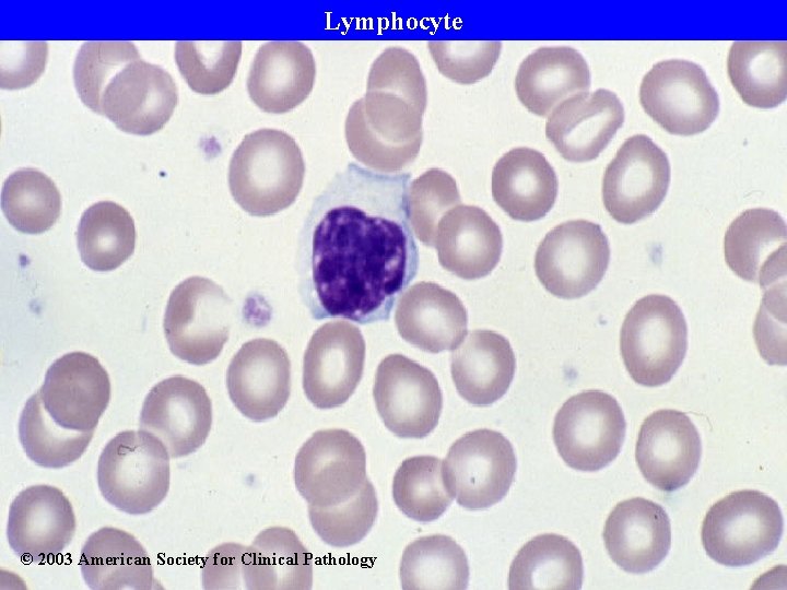 Lymphocyte © 2003 American Society for Clinical Pathology 