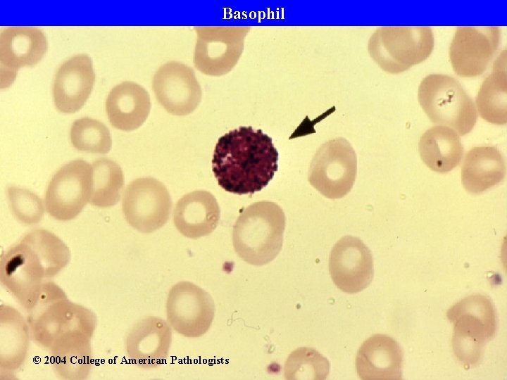 Basophil © 2004 College of American Pathologists 