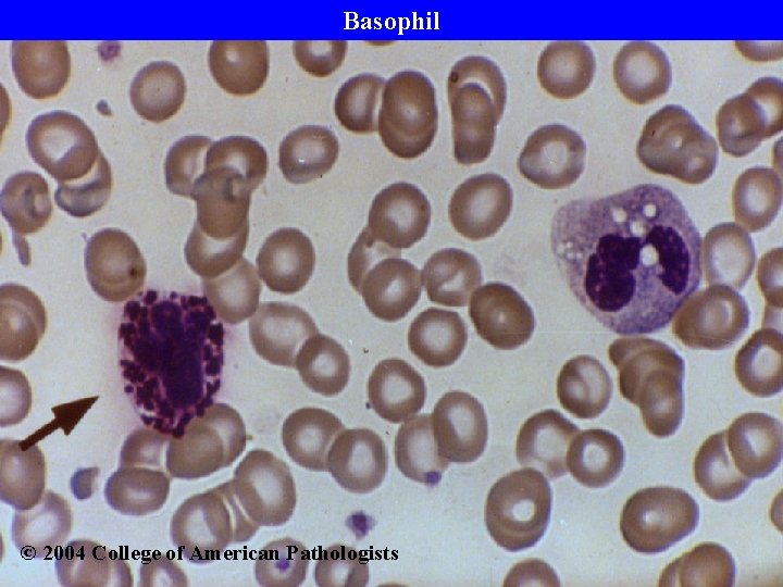 Basophil © 2004 College of American Pathologists 