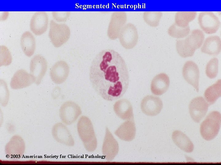 Segmented Neutrophil © 2003 American Society for Clinical Pathology 