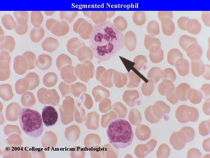 Segmented Neutrophil © 2004 College of American Pathologists 