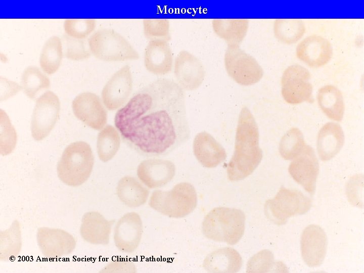 Monocyte © 2003 American Society for Clinical Pathology 