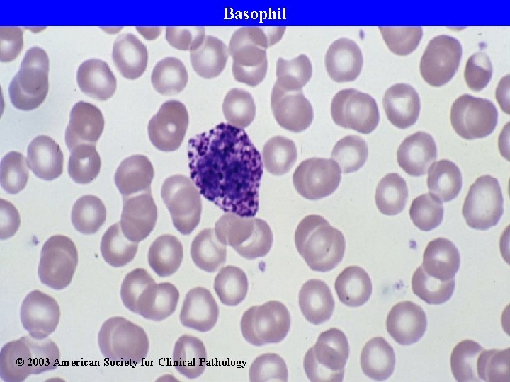 Basophil © 2003 American Society for Clinical Pathology 