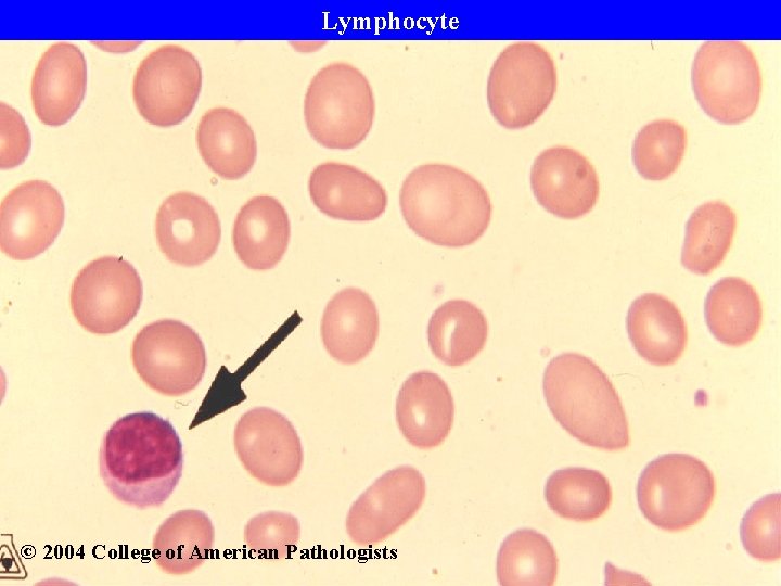 Lymphocyte © 2004 College of American Pathologists 