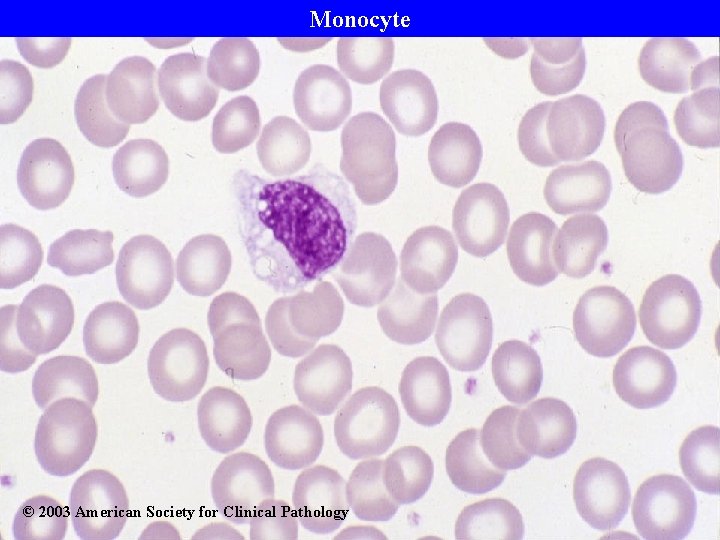 Monocyte © 2003 American Society for Clinical Pathology 