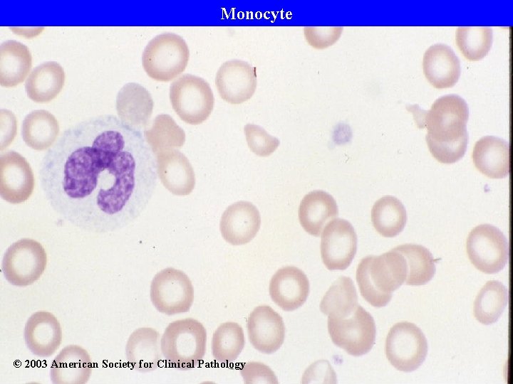 Monocyte © 2003 American Society for Clinical Pathology 