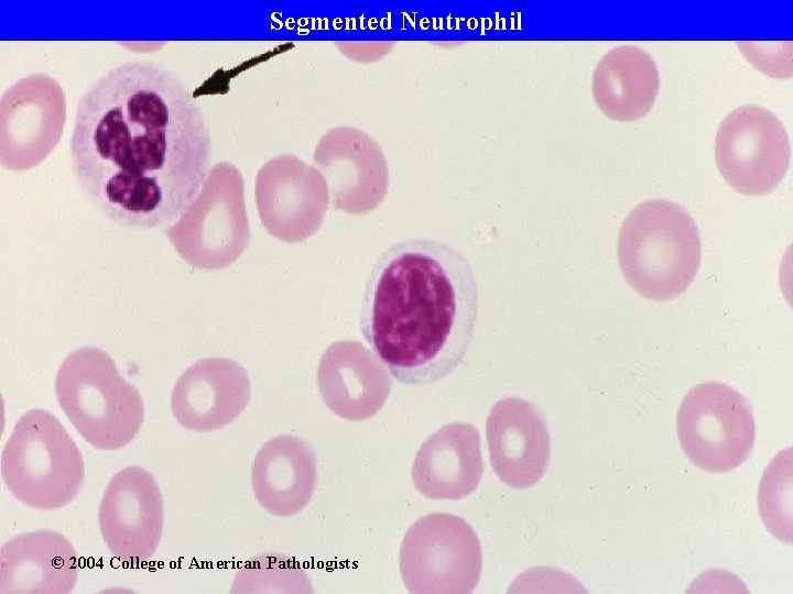 Segmented Neutrophil © 2004 College of American Pathologists 