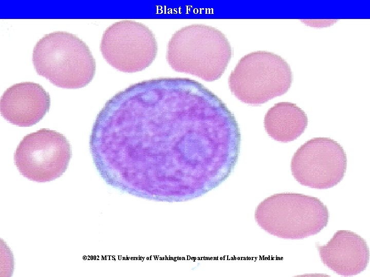 Blast Form © 2002 MTS, University of Washington Department of Laboratory Medicine 