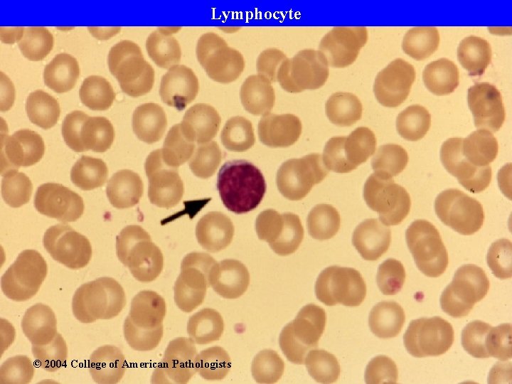 Lymphocyte © 2004 College of American Pathologists 