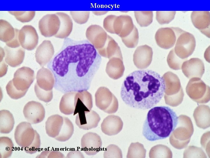 Monocyte © 2004 College of American Pathologists 