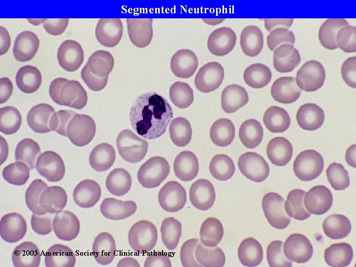 Segmented Neutrophil © 2003 American Society for Clinical Pathology 