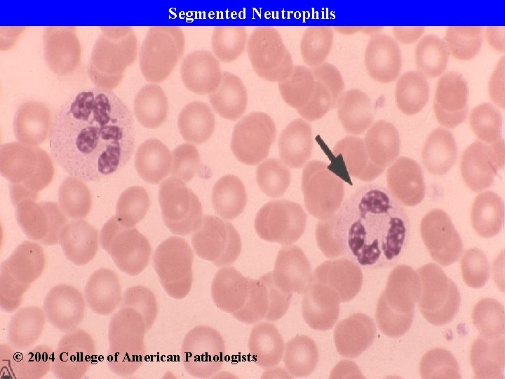 Segmented Neutrophils © 2004 College of American Pathologists 