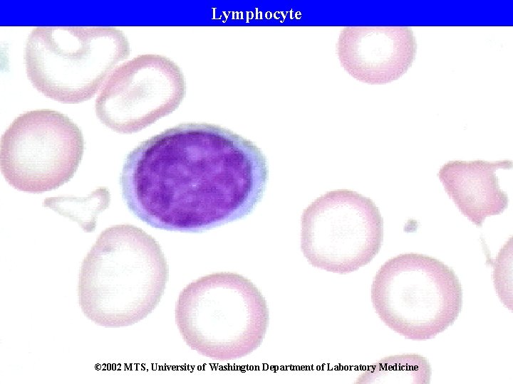 Lymphocyte © 2002 MTS, University of Washington Department of Laboratory Medicine 