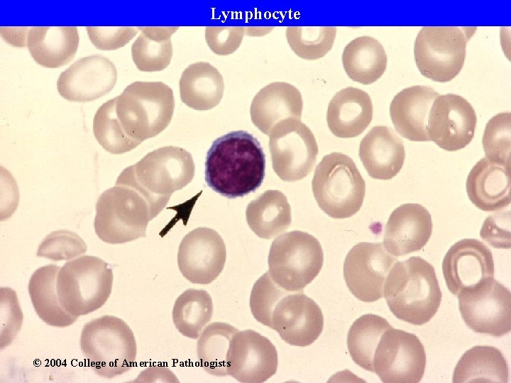 Lymphocyte © 2004 College of American Pathologists 