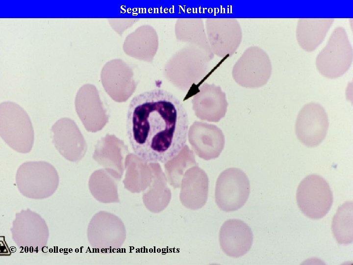 Segmented Neutrophil © 2004 College of American Pathologists 