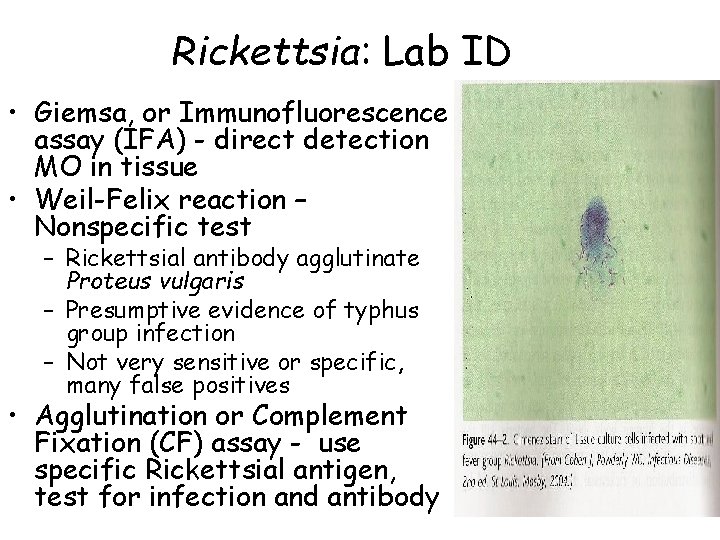 Rickettsia: Lab ID • Giemsa, or Immunofluorescence assay (IFA) - direct detection MO in