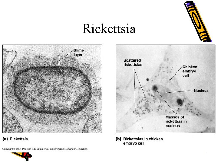 Rickettsia 