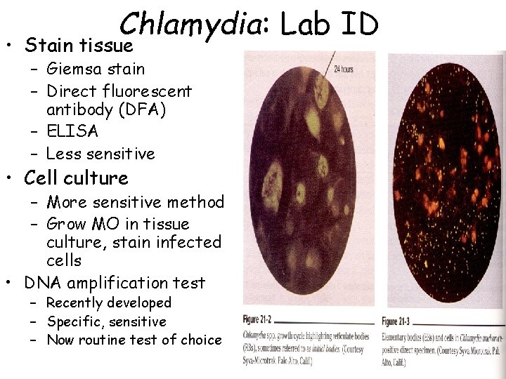 Chlamydia: Lab ID • Stain tissue – Giemsa stain – Direct fluorescent antibody (DFA)